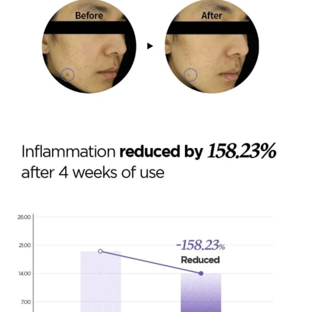 Patch anti-spot Onion Newpair SKINFIT (Exp: 26.03.2026)