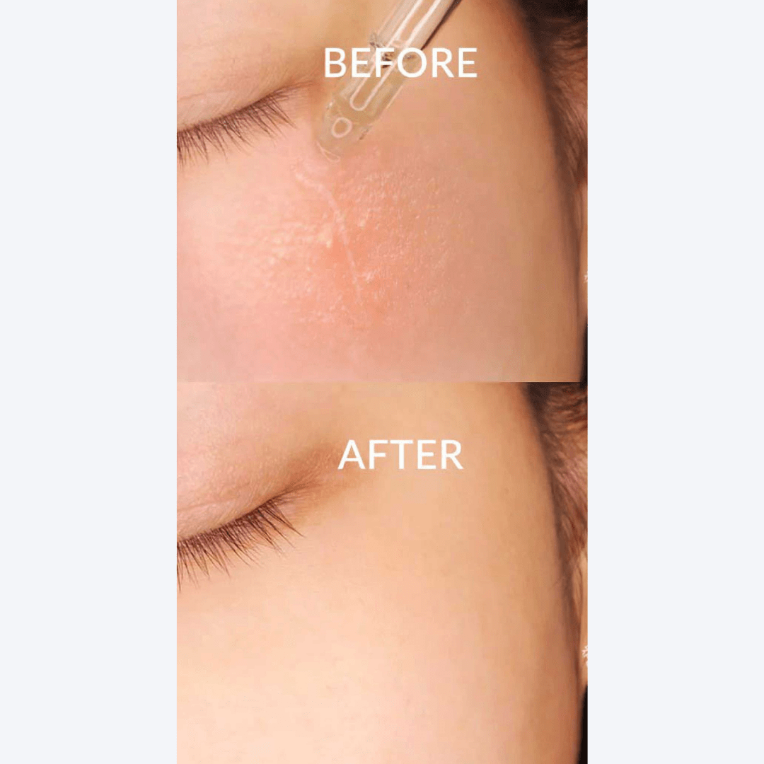 dr-althea-skin-relief-essence-30-ml